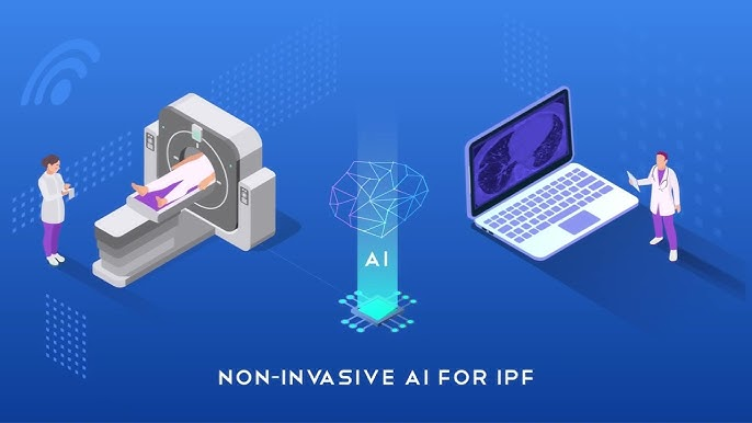 The integration of AI into medical diagnostics, exemplified by FIBRESOLVE's FDA authorisation , signifies a pivotal advancement in healthcare technology.