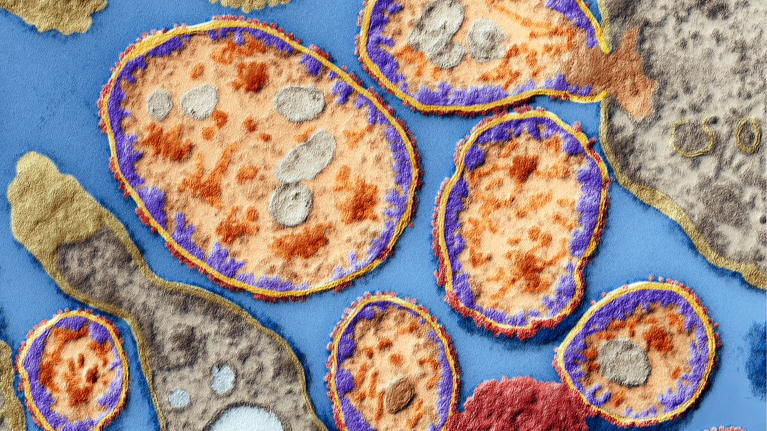Virologist Beata Halassy, diagnosed with aggressive recurrent breast cancer in 2016, developed and self-administered lab-grown oncolytic viruses
