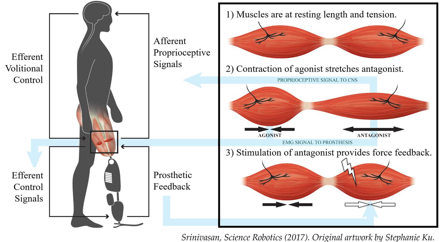 This MIT Media Lab project page outlines the Agonist–Antagonist Myoneural Interface (AMI), a surgical technique that links paired muscles in an amputated limb so one stretches when the other contracts, recreating proprioceptive signalling to the nervous system.